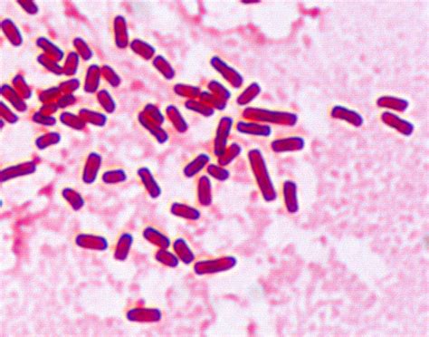 Enterobacter aerogenes .